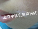 沿Ϊ׸